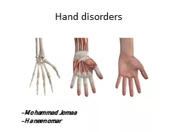 Hand disorders -Mohammad