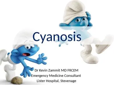 Cyanosis Dr Kevin  Zammit