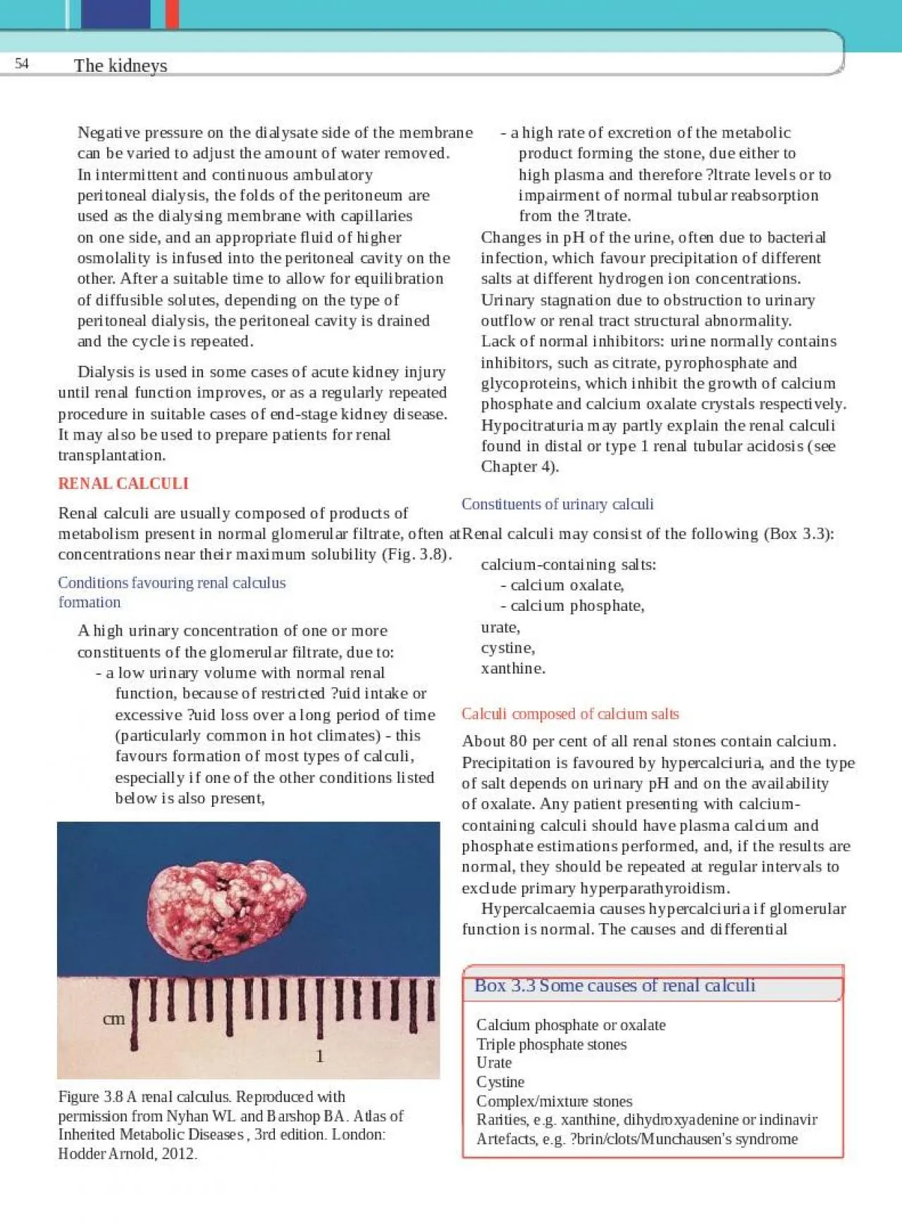 PPT-The kidneys 54 Negative pressure on the dialysate side of the membrane