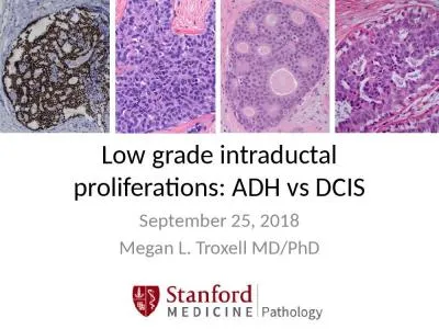 Low grade  intraductal  proliferations: ADH