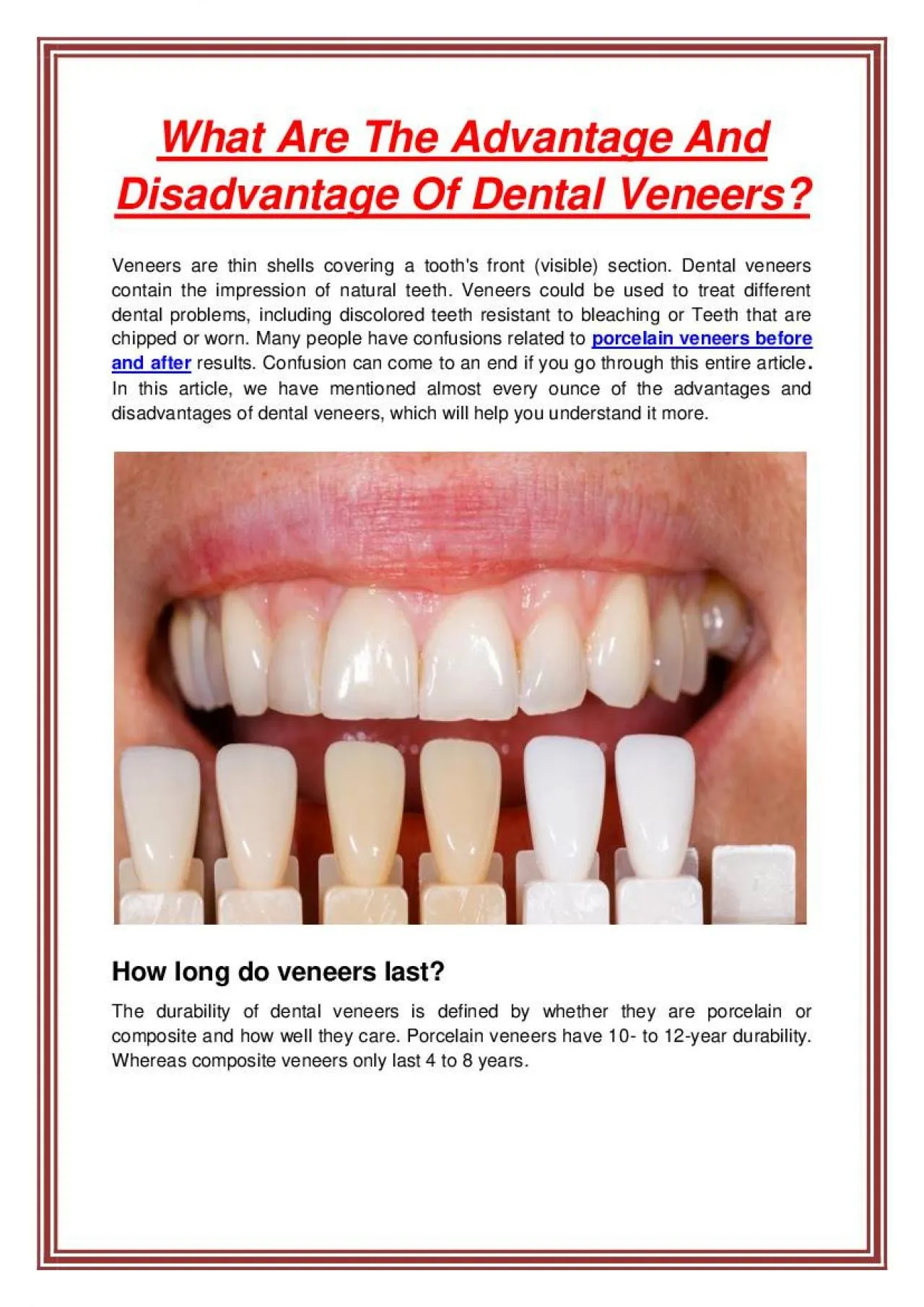 PDF-What Are The Advantage And Disadvantage Of Dental Veneers?