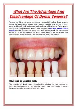What Are The Advantage And Disadvantage Of Dental Veneers?