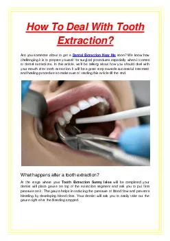 How To Deal With Tooth Extraction?