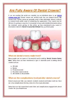 Are Fully Aware Of Dental Crowns?