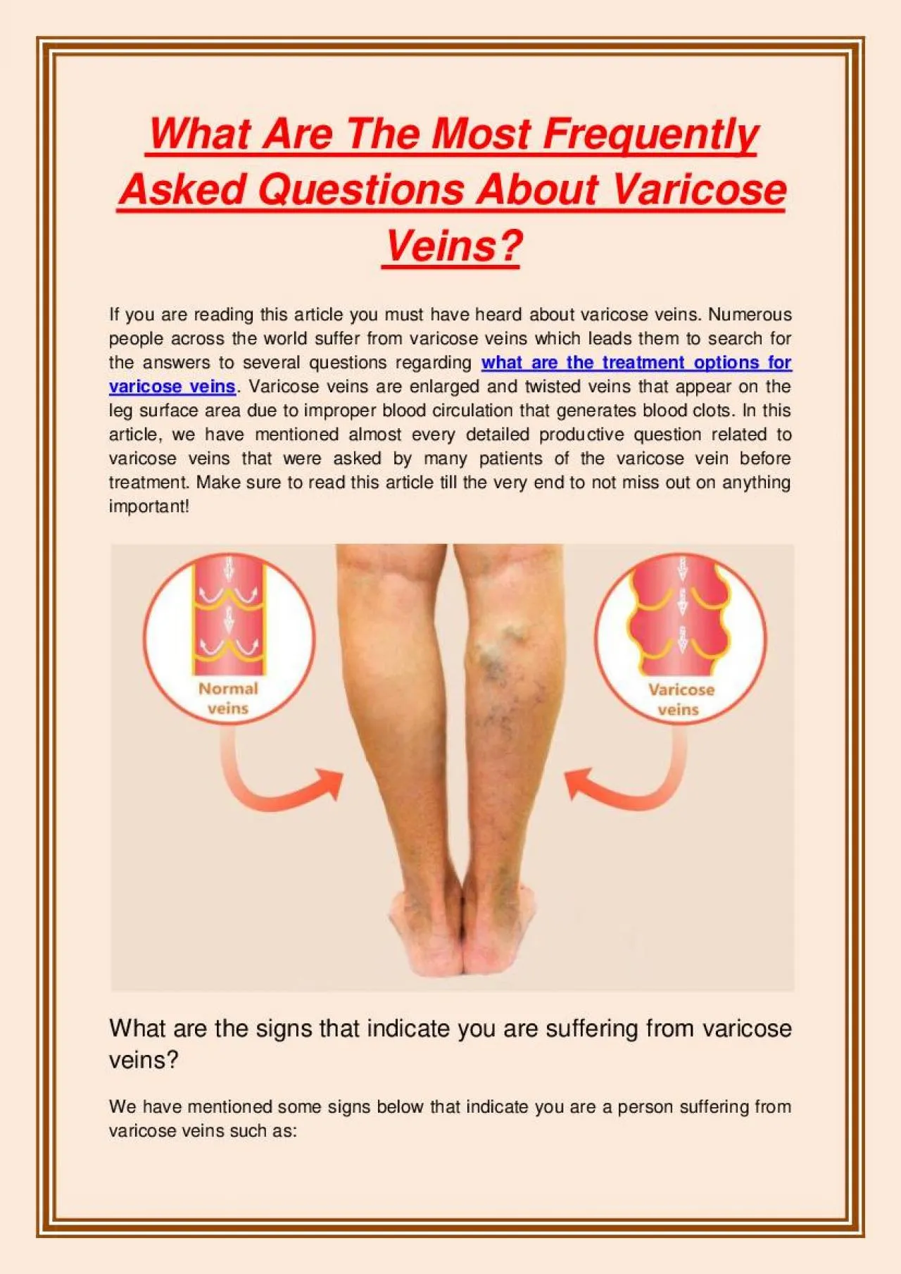 PDF-What Are The Most Frequently Asked Questions About Varicose Veins?