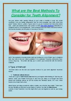 What are the Best Methods To Consider for Teeth Alignment?