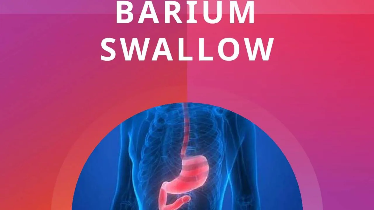 PPT-BARIUM SWALLOW Barium swallow