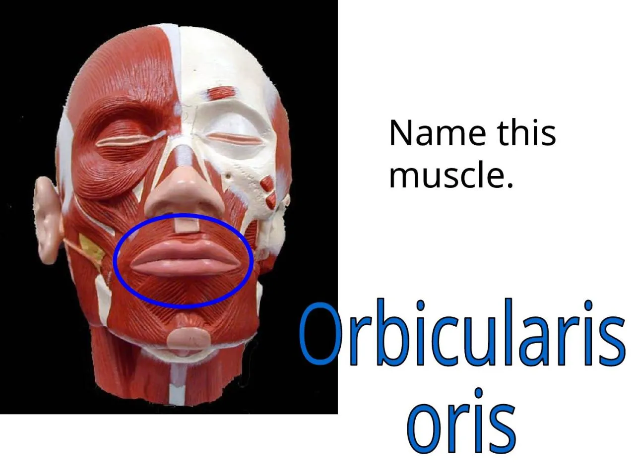 PPT-Name this muscle. Orbicularis