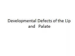 Developmental Defects of the Lip and   Palate