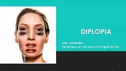 PPT-DIPLOPIA Oleh : Nanda Febry