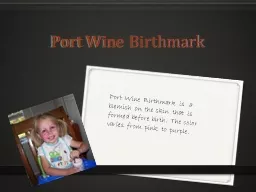 Port Wine Birthmark Port Wine Birthmark is  a blemish on the skin that is formed before birth. The