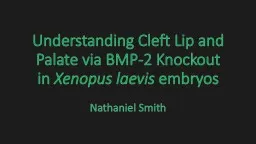 Understanding  Cleft Lip and Palate via