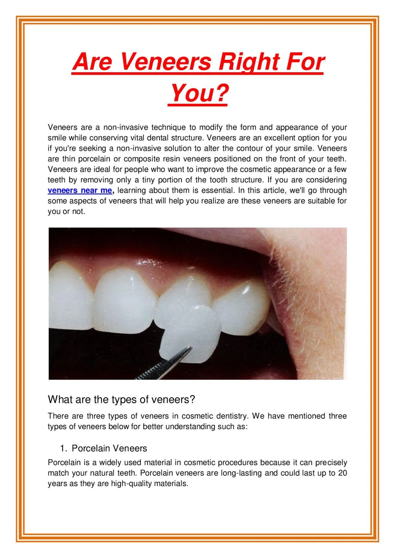 PDF-Are Veneers Right For You?