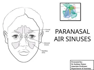 PARANASAL AIR SINUSES Presented by:-