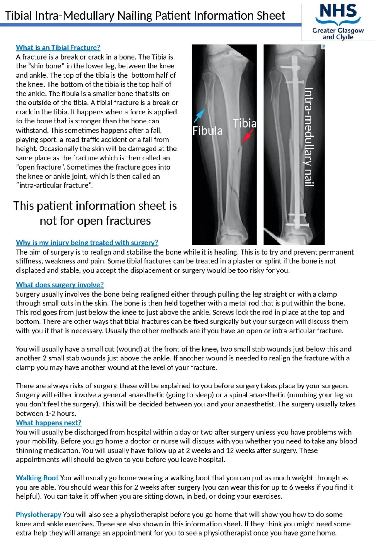 PPT-Tibial Intra-Medullary Nailing Patient Information Sheet