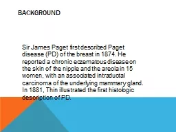 Sir James Paget first described Paget disease (PD) of the breast in 1874. He reported