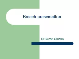 Breech presentation Dr  Sume