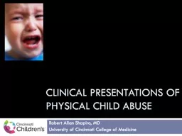 Clinical presentations of Physical child abuse