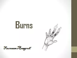 Burns  Tasneem   Anagreh
