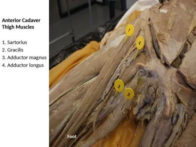 Anterior Cadaver  Thigh Muscles