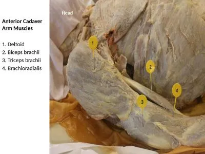 Anterior Cadaver Arm Muscles