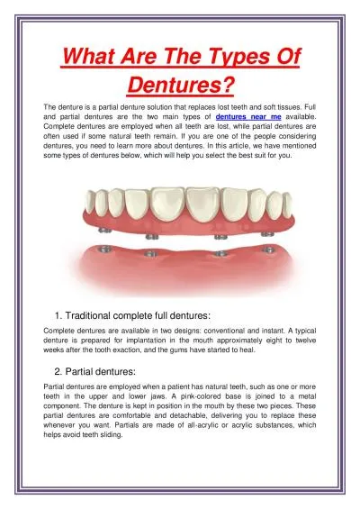 What Are The Types Of Dentures?