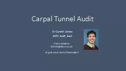 Carpal Tunnel Audit Dr Gareth James