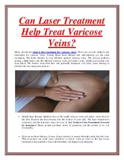 Can Laser Treatment Help Treat Varicose Veins?