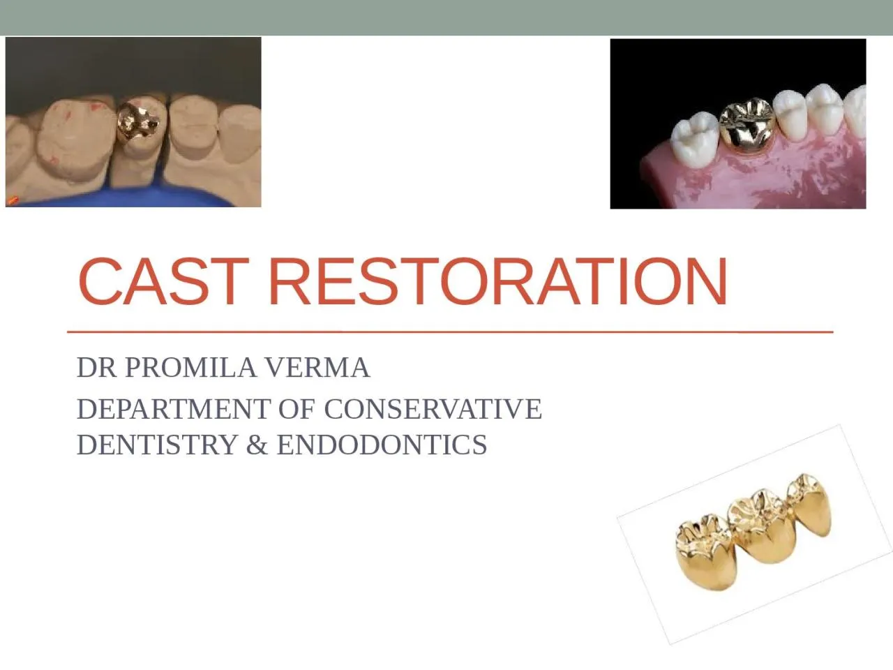 PPT-Cast restoration DR PROMILA VERMA