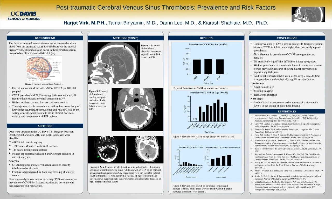 PPT-The dural or cerebral venous sinuses are structures that drain blood from the brain