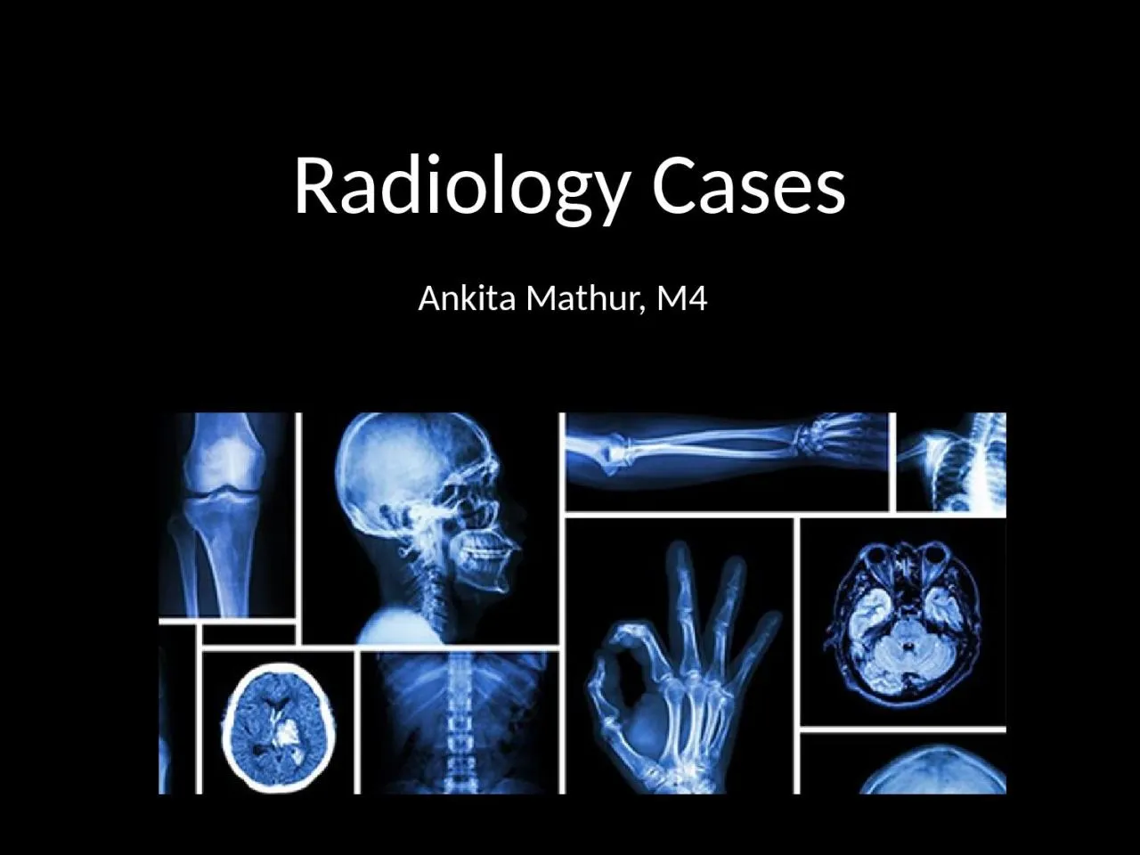 PPT-Radiology Cases Ankita Mathur, M4