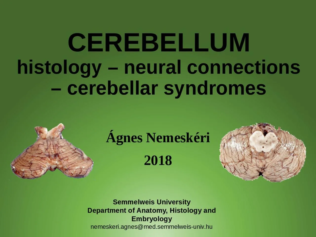 PPT-CEREBELLUM histology – neural connections – cerebellar syndromes