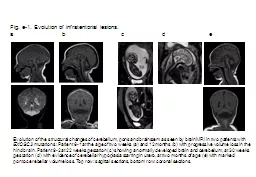 Evolution  of the structural changes of cerebellum,