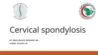 Cervical spondylosis  B y