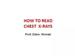 HOW TO READ CHEST   X-RAYS