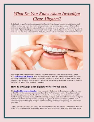 What Do You Know About Invisalign Clear Aligners?