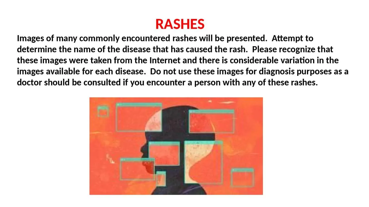 PPT-RASHES Images of many commonly encountered rashes will be presented. Attempt to determine