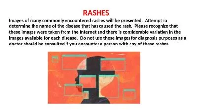 RASHES Images of many commonly encountered rashes will be presented.  Attempt to determine th