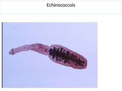 Echinococcois Echinococcois