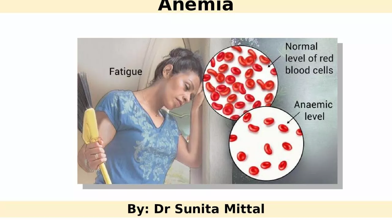 Anemia By:  Dr  Sunita Mittal