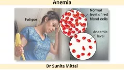 Anemia By:  Dr  Sunita Mittal