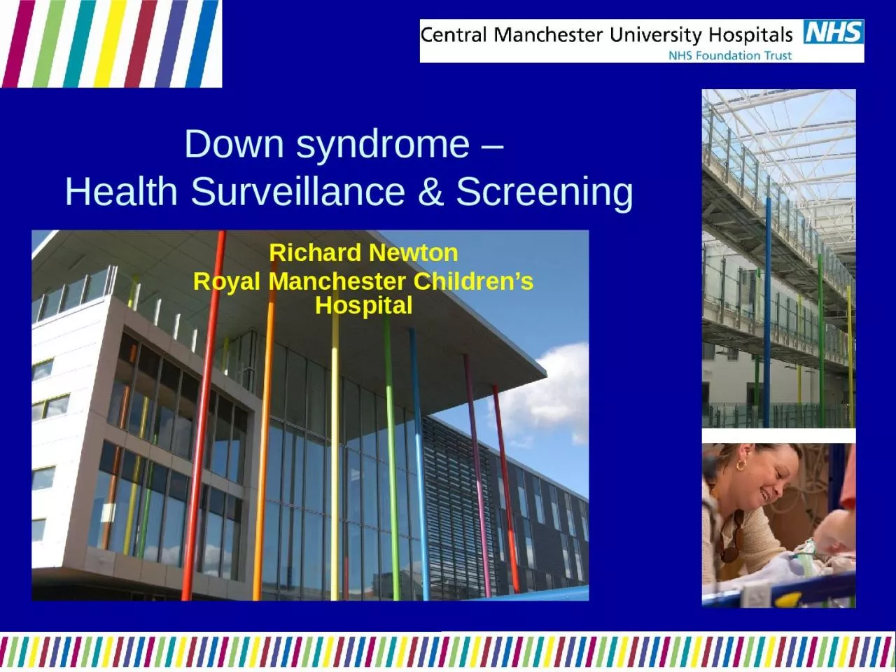 Down syndrome –  Health Surveillance & Screening