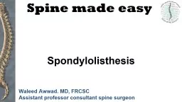 Spine  m ade easy Spondylolisthesis
