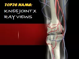 KNEE JOINT X RAY VIEWS