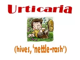 Urticaria (hives, ‘nettle-rash’)