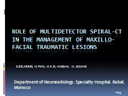 ROLE OF MULTIDETECTOR SPIRAL-CT IN THE MANAGEMENT OF MAXILLO-FACIAL