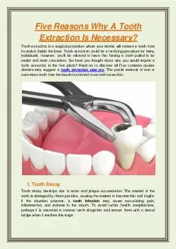 Five Reasons Why A Tooth Extraction Is Necessary?