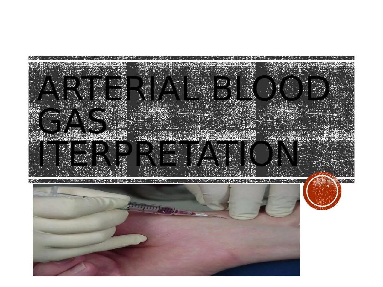 PPT-Arterial Blood Gas Iterpretation