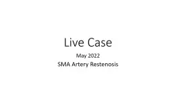 Live Case May 2022  SMA Artery Restenosis