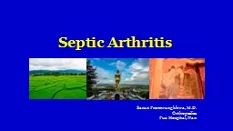 Septic Arthritis  Saran